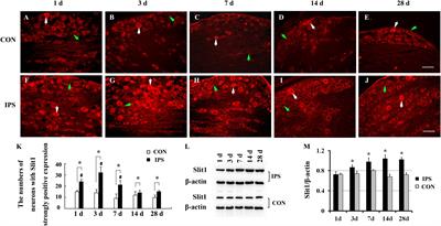 The ATP-P2X7 Signaling Pathway Participates in the Regulation of Slit1 Expression in Satellite Glial Cells